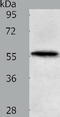 Matrilin 4 antibody, TA322819, Origene, Western Blot image 
