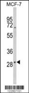 Iodothyronine Deiodinase 2 antibody, 63-610, ProSci, Western Blot image 