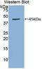 TNF Receptor Superfamily Member 13C antibody, LS-C292969, Lifespan Biosciences, Western Blot image 