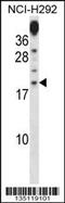 Proline Rich 15 antibody, 58-145, ProSci, Western Blot image 