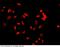 Jumonji Domain Containing 6, Arginine Demethylase And Lysine Hydroxylase antibody, 100720-T34, Sino Biological, Immunohistochemistry paraffin image 