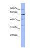 Pre-MRNA Processing Factor 4 antibody, NBP1-57150, Novus Biologicals, Western Blot image 