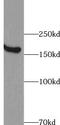 Zinc Finger FYVE-Type Containing 16 antibody, FNab09628, FineTest, Western Blot image 
