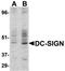 CD209 Molecule antibody, TA319909, Origene, Western Blot image 