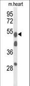 Alpha-1-B Glycoprotein antibody, LS-C155815, Lifespan Biosciences, Western Blot image 