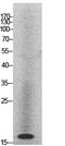 Histone Cluster 1 H2A Family Member M antibody, A16318, Boster Biological Technology, Western Blot image 