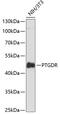 Prostaglandin D2 receptor antibody, 14-679, ProSci, Western Blot image 