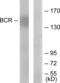 BCR Activator Of RhoGEF And GTPase antibody, LS-C118065, Lifespan Biosciences, Western Blot image 