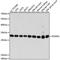 Phosphoglycerate Mutase 1 antibody, A4015, ABclonal Technology, Western Blot image 