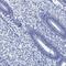 Calcium Binding Tyrosine Phosphorylation Regulated antibody, PA5-59256, Invitrogen Antibodies, Immunohistochemistry frozen image 