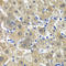 Methionine Adenosyltransferase 1A antibody, A6650, ABclonal Technology, Immunohistochemistry paraffin image 