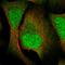 Vesicle Trafficking 1 antibody, HPA030969, Atlas Antibodies, Immunofluorescence image 