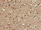 Carbohydrate sulfotransferase 1 antibody, LS-C677539, Lifespan Biosciences, Immunohistochemistry paraffin image 