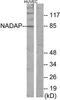 Solute Carrier Family 4 Member 1 Adaptor Protein antibody, TA315208, Origene, Western Blot image 
