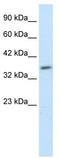 Hes Related Family BHLH Transcription Factor With YRPW Motif Like antibody, TA329430, Origene, Western Blot image 