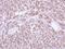 Protein-L-Isoaspartate (D-Aspartate) O-Methyltransferase antibody, GTX110556, GeneTex, Immunohistochemistry paraffin image 