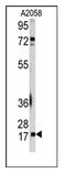 SUMO-conjugating enzyme UBC9 antibody, AP11077PU-N, Origene, Western Blot image 