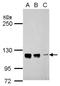 Cutaneous T-cell lymphoma-associated antigen 5 antibody, NBP2-16022, Novus Biologicals, Western Blot image 