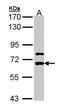 Leucine Rich Glioma Inactivated 1 antibody, PA5-28291, Invitrogen Antibodies, Western Blot image 