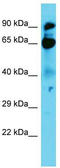 Nucleolar Protein 9 antibody, TA330743, Origene, Western Blot image 
