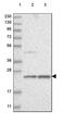 ERI1 Exoribonuclease Family Member 3 antibody, PA5-56288, Invitrogen Antibodies, Western Blot image 