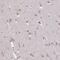SUMO Specific Peptidase 3 antibody, NBP2-32525, Novus Biologicals, Immunohistochemistry paraffin image 