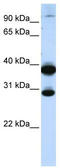 Zinc Finger Protein 138 antibody, TA342442, Origene, Western Blot image 