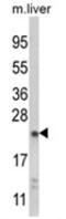 N-Ribosyldihydronicotinamide:Quinone Reductase 2 antibody, AP18140PU-N, Origene, Western Blot image 