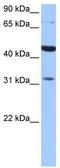 Putative protein TPRXL antibody, TA339921, Origene, Western Blot image 