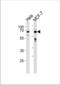 Forkhead Box O3 antibody, TA324516, Origene, Western Blot image 