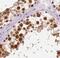 Zinc Finger Protein 571 antibody, FNab09715, FineTest, Immunohistochemistry paraffin image 
