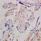 Adenylate Cyclase 10 antibody, orb4345, Biorbyt, Immunohistochemistry paraffin image 