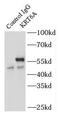 Keratin 6A antibody, FNab02216, FineTest, Immunoprecipitation image 