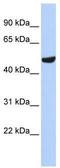 Septin 11 antibody, TA344894, Origene, Western Blot image 