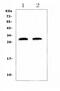 C-Reactive Protein antibody, A00249-2, Boster Biological Technology, Western Blot image 