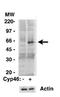 Cholesterol 24-hydroxylase antibody, GTX30682, GeneTex, Western Blot image 