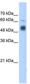 Glucosaminyl (N-Acetyl) Transferase 3, Mucin Type antibody, TA332087, Origene, Western Blot image 