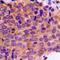 Killer Cell Immunoglobulin Like Receptor, Two Ig Domains And Short Cytoplasmic Tail 5 antibody, orb214161, Biorbyt, Immunohistochemistry paraffin image 