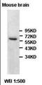 2-Hydroxyacyl-CoA Lyase 1 antibody, orb96227, Biorbyt, Western Blot image 