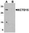 BTB/POZ domain-containing protein KCTD15 antibody, A08651, Boster Biological Technology, Western Blot image 