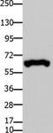 Forkhead Box P1 antibody, TA321921, Origene, Western Blot image 