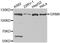 Glutamate Metabotropic Receptor 8 antibody, A2964, ABclonal Technology, Western Blot image 