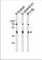 Cholecystokinin A Receptor antibody, TA328192, Origene, Western Blot image 