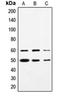 SS18 Subunit Of BAF Chromatin Remodeling Complex antibody, orb214615, Biorbyt, Western Blot image 