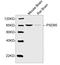Discs Large MAGUK Scaffold Protein 4 antibody, LS-C203195, Lifespan Biosciences, Western Blot image 