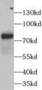 Furin, Paired Basic Amino Acid Cleaving Enzyme antibody, FNab03241, FineTest, Western Blot image 