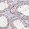Cap Methyltransferase 2 antibody, NBP2-30944, Novus Biologicals, Immunohistochemistry frozen image 