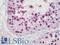 Metastasis Associated 1 antibody, LS-B11031, Lifespan Biosciences, Immunohistochemistry frozen image 