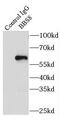Tetratricopeptide Repeat Domain 8 antibody, FNab00824, FineTest, Immunoprecipitation image 
