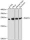RAB7A, Member RAS Oncogene Family antibody, 14-627, ProSci, Western Blot image 